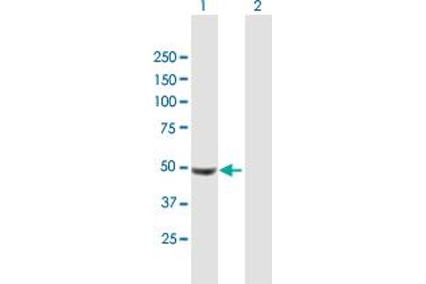UCKL1 抗体  (AA 1-419)