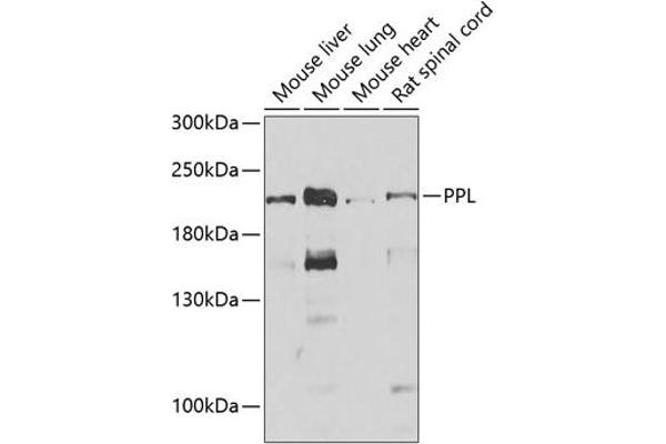 PPL 抗体  (AA 1-130)
