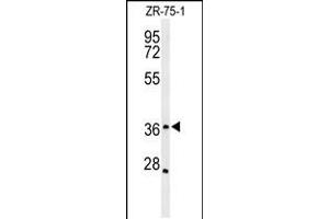 Western blot analysis of MIIP Antibody in ZR-75-1 cell line lysates (35ug/lane) (MIIP 抗体  (C-Term))