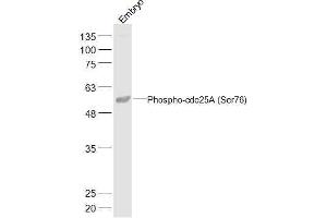 Mouse Embryo lysates probed with Phospho-cdc25A (Ser76) Polyclonal Antibody, Unconjugated  at 1:500 dilution and 4˚C overnight incubation. (CDC25A 抗体  (pSer76))