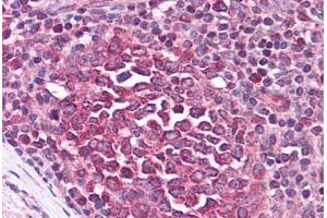 Human Tonsil (formalin-fixed, paraffin-embedded) stained with IRAK3 antibody ABIN213946 at 2 ug/ml followed by biotinylated goat anti-rabbit IgG secondary antibody ABIN481713, alkaline phosphatase-streptavidin and chromogen. (IRAK3 抗体  (C-Term))