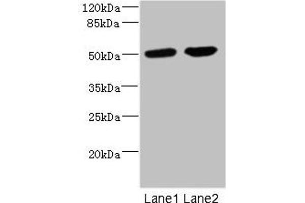 CHRNA1 抗体  (AA 25-240)