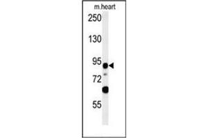Western blot analysis of LRRC36 Antibody (N-term) in mouse heart tissue lysates (35ug/lane). (LRRC36 抗体  (N-Term))