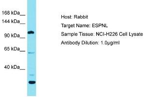 Host: Rabbit Target Name: ESPNL Sample Tissue: Human NCI-H226 Whole Cell Antibody Dilution: 1ug/ml (ESPNL 抗体  (C-Term))