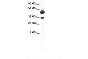 Image no. 1 for anti-Thyroid Hormone Receptor, beta (THRB) (AA 53-102) antibody (ABIN6736050) (THRB 抗体  (AA 53-102))