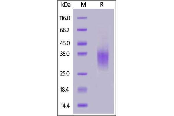 Glucagon Receptor Protein (GCGR) (AA 26-136) (His tag)