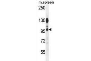 Western Blotting (WB) image for anti-ArfGAP with Coiled-Coil, Ankyrin Repeat and PH Domains 1 (ACAP1) antibody (ABIN2996040) (ACAP1 抗体)