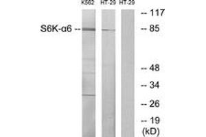Western Blotting (WB) image for anti-Ribosomal Protein S6 Kinase, 90kDa, Polypeptide 6 (RPS6KA6) (AA 661-710) antibody (ABIN2889803) (RPS6KA6 抗体  (AA 661-710))