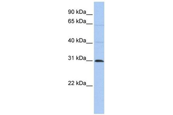 METTL11B 抗体  (C-Term)