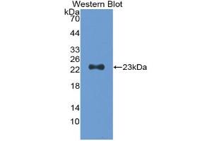 Western blot analysis of the recombinant protein. (TNNI1 抗体  (AA 1-187))