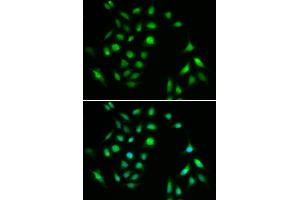 Immunofluorescence analysis of A549 cell using CHUK antibody. (IKK alpha 抗体)