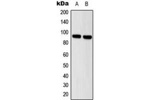 Western blot analysis of STAT5 expression in HeLa (A), A431 (B) whole cell lysates. (STAT5A 抗体  (Center))