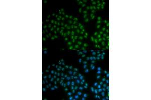 Immunofluorescence analysis of A549 cells using SOX2 antibody. (SOX2 抗体)