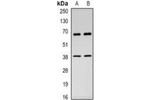 Western blot analysis of c-Rel expression in Hela (A), HEK293T (B) whole cell lysates. (c-Rel 抗体  (C-Term))