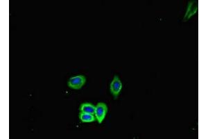 Immunofluorescent analysis of HepG2 cells using ABIN7177169 at dilution of 1:100 and Alexa Fluor 488-congugated AffiniPure Goat Anti-Rabbit IgG(H+L) (GRP78 抗体  (AA 20-655))