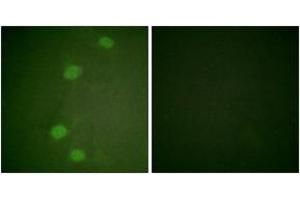 Immunofluorescence analysis of HeLa cells, using Retinoblastoma (Phospho-Ser249) Antibody. (Retinoblastoma Protein (Rb) 抗体  (pSer249))