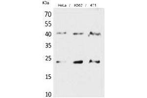 Western Blot analysis of hela, K562, 4T1 cells using TMEM173 Polyclonal Antibody. (STING/TMEM173 抗体  (C-Term))