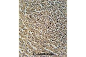 Immunohistochemistry (IHC) image for anti-RAS Protein Activator Like 3 (RASAL3) antibody (ABIN2995724) (RASAL3 抗体)