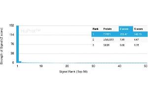 Analysis of Protein Array containing more than 19,000 full-length human proteins using TYRP1-Monospecific Mouse Monoclonal Antibody (TYRP1/3282) Z- and S- Score: The Z-score represents the strength of a signal that a monoclonal antibody (Monoclonal Antibody) (in combination with a fluorescently-tagged anti-IgG secondary antibody) produces when binding to a particular protein on the HuProtTM array. (Tyrosinase-Related Protein 1 抗体  (AA 257-377))