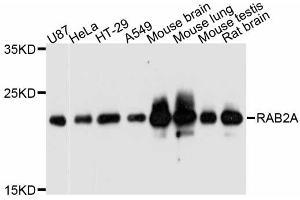 Western blot analysis of extracts of various cell lines, using RAB2A antibody (ABIN5998650) at 1:3000 dilution. (RAB2A 抗体)