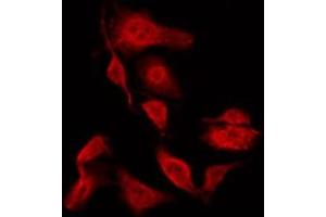 ABIN6267294 staining HeLa by IF/ICC. (HSP27 抗体  (pSer15))