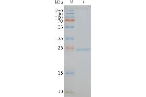 Human CD81-Nanodisc, Flag Tag on SDS-PAGE (CD81 Protein (CD81))