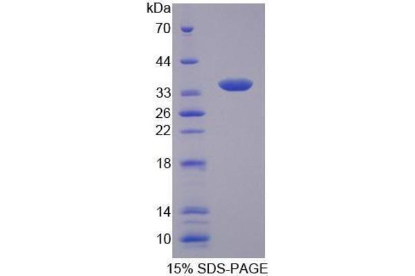 Slc25a1 Protein (AA 19-311) (His tag)