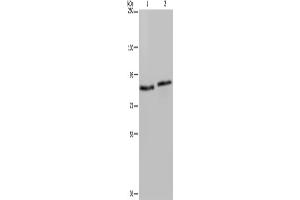 Western Blotting (WB) image for anti-Integrin beta 2 (ITGB2) antibody (ABIN2430320) (Integrin beta 2 抗体)