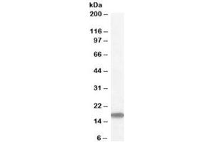 Western blot testing of human testis lysate with STMN1 antibody at 1ug/ml. (Stathmin 1 抗体)