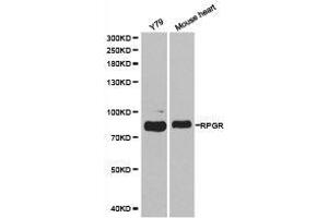 Western Blotting (WB) image for anti-Retinitis Pigmentosa GTPase Regulator (RPGR) antibody (ABIN1874639) (RPGR 抗体)