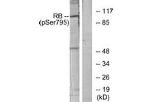 Western Blotting (WB) image for anti-Retinoblastoma Protein (Rb Protein) (pSer795) antibody (ABIN2888520) (Retinoblastoma Protein (Rb) 抗体  (pSer795))