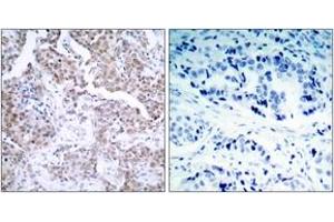 Immunohistochemistry (IHC) image for anti-Tumor Protein P53 (TP53) (pSer15) antibody (ABIN2888497) (p53 抗体  (pSer15))