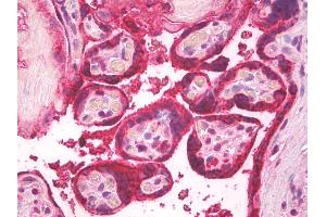 Anti-Luteinizing Hormone antibody IHC of human placenta. (Luteinizing Hormone 抗体)