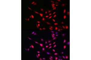 Immunofluorescence analysis of NIH/3T3 cells using UFM1 Rabbit pAb (ABIN7271184) at dilution of 1:150 (40x lens). (UFM1 抗体  (AA 1-85))