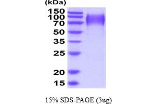 PODXL Protein (AA 22-404) (His tag)