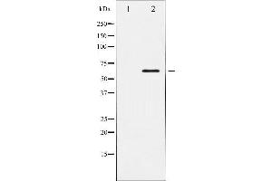 Western Blotting (WB) image for anti-ELK1, Member of ETS Oncogene Family (ELK1) antibody (ABIN1846330) (ELK1 抗体)