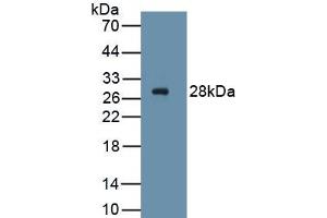 Detection of Recombinant PDGFRa, Human using Monoclonal Antibody to Platelet Derived Growth Factor Receptor Alpha (PDGFRa) (PDGFRA 抗体  (AA 170-387))