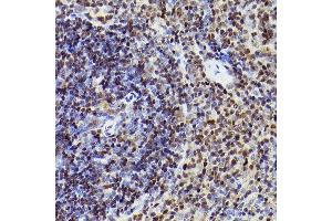 Immunohistochemistry of paraffin-embedded mouse spleen using MEF2A+MEF2C Rabbit mAb (ABIN1679049, ABIN1679050, ABIN7101495 and ABIN7101496) at dilution of 1:100 (40x lens). (MEF2A+MEF2C 抗体)
