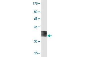 Western Blot detection against Immunogen (36. (Ferredoxin1 (FDX1) (AA 85-183) 抗体)