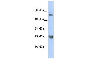 TNFSF12 antibody used at 1 ug/ml to detect target protein. (TWEAK 抗体)