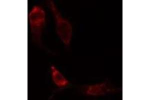 ABIN6275203 staining Hela cells by IF/ICC. (DCT 抗体  (N-Term))