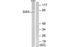 Western Blotting (WB) image for anti-Homeobox protein SIX5 (SIX5) (Internal Region) antibody (ABIN1851462) (Six5 抗体  (Internal Region))
