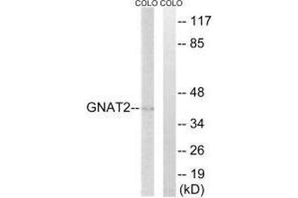 GNAT2 抗体