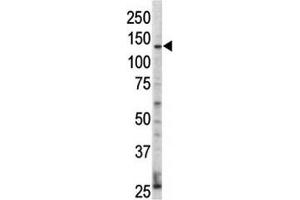 Western blot analysis of ErbB4 / HER4 antibody and HL-60 cell lysate. (ERBB4 抗体  (AA 25-55))