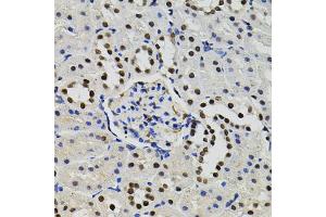 Immunohistochemistry of paraffin-embedded rat kidney using GTF2I antibody (ABIN5995399) (40x lens). (GTF2I 抗体)