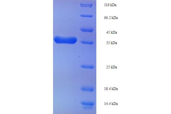 SUPT16H Protein (AA 890-1074, partial) (His-SUMO Tag)