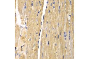 Immunohistochemistry of paraffin-embedded mouse heart using SLC25A13 antibody. (slc25a13 抗体)