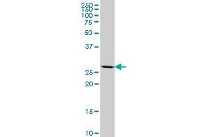 MEOX2 monoclonal antibody (M11), clone 4B2 Western Blot analysis of MEOX2 expression in MCF-7 . (MEOX2 抗体  (AA 1-303))