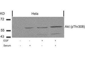 Image no. 2 for anti-V-Akt Murine Thymoma Viral Oncogene Homolog 1 (AKT1) (pThr308) antibody (ABIN196711) (AKT1 抗体  (pThr308))