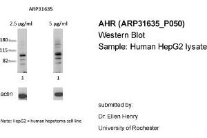 Western Blotting (WB) image for anti-Aryl Hydrocarbon Receptor (AHR) (N-Term) antibody (ABIN182389) (Aryl Hydrocarbon Receptor 抗体  (N-Term))